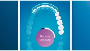 Philips Sonicare DiamondClean Smart 9500 Rechargeable Electric Power Toothbrush, Rose Gold (HX9924/61) 13 Philips DiamondClean Smart 9500 (HX9924/61) Sonicare Sonic electric toothbrush